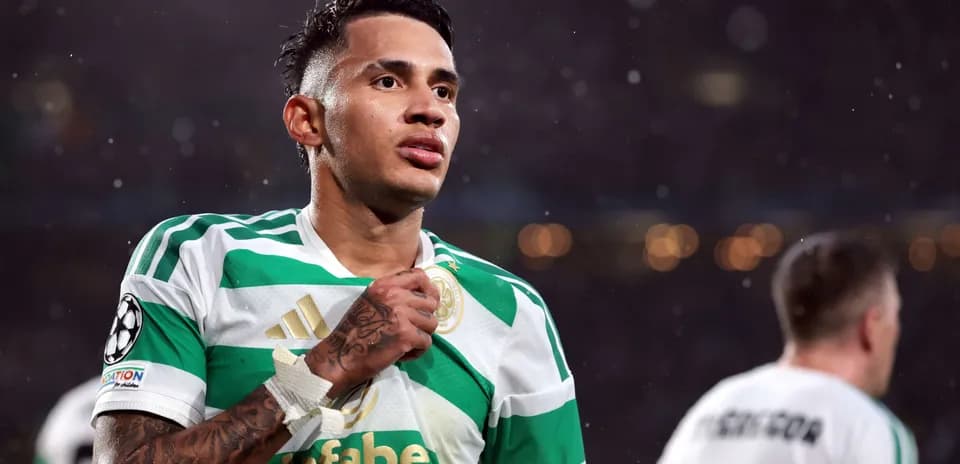Jugador de Celtic mostrando su camiseta